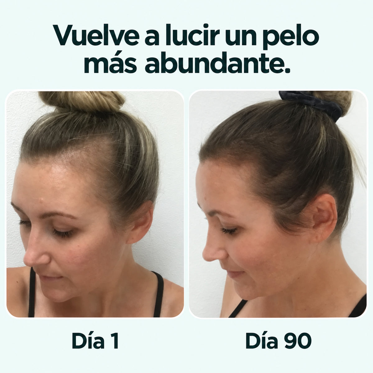 PDRN Reedle Shot Hair Brush Serum