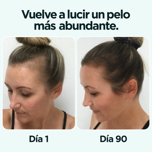 PDRN Reedle Shot Hair Brush Serum
